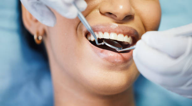Best Knocked-Out Tooth (Avulsed Tooth) Treatment in Walsenburg, CO